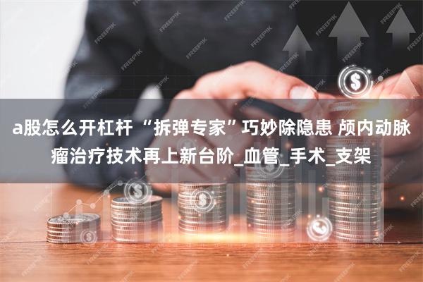 a股怎么开杠杆 “拆弹专家”巧妙除隐患 颅内动脉瘤治疗技术再上新台阶_血管_手术_支架